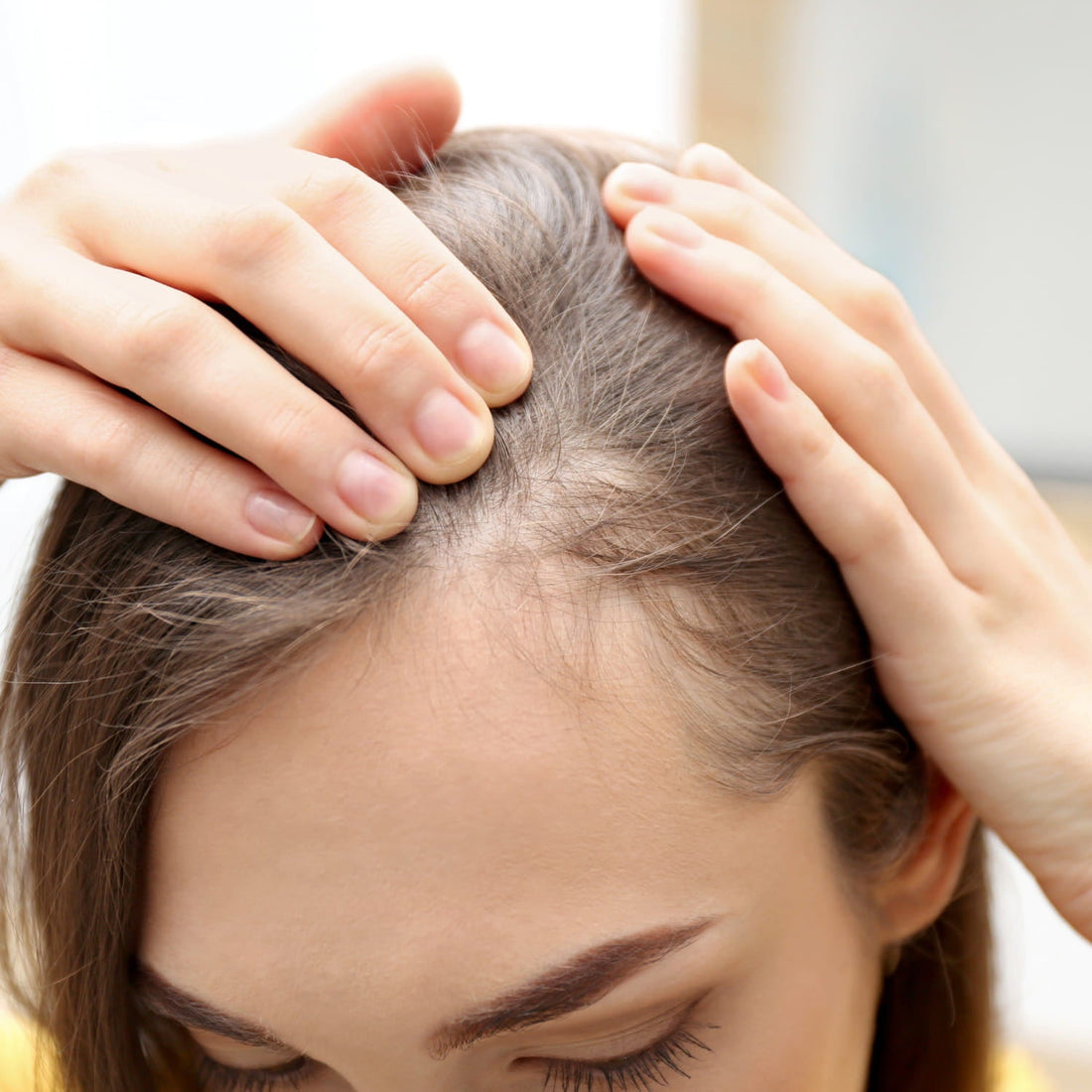 How to Prevent Hair Thinning